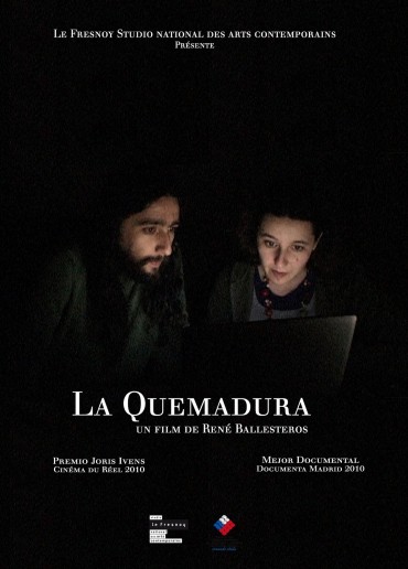 La quemadura